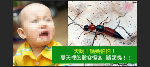 男孩誤用藥物，拍打隱翅蟲(chóng)后全身潰爛的悲劇