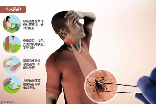 男童高燒不退，全家竟感染肝吸蟲(chóng)——警惕生活細(xì)節(jié)中的健康隱患