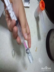 震撼！7歲孩子霧化后竟咳出活體螞蝗——揭秘醫(yī)療事件背后的驚險時刻