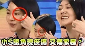 宋佳視后領(lǐng)獎現(xiàn)場哭了(宋佳視后領(lǐng)獎現(xiàn)場哭了視頻)
